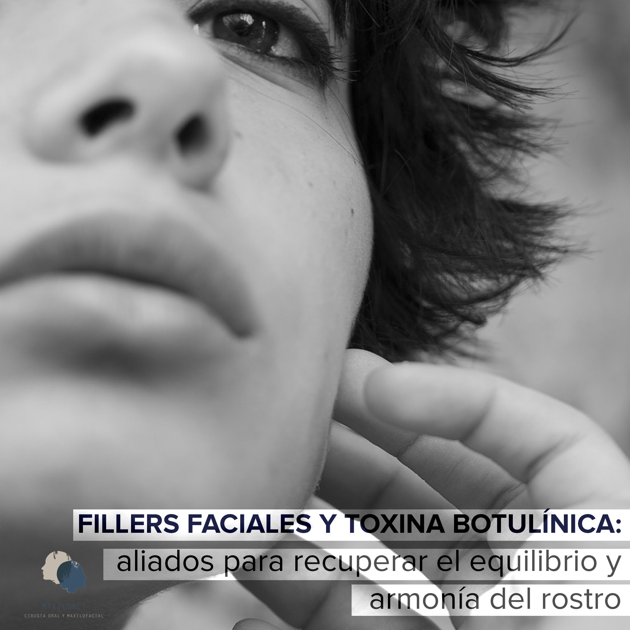 Fillers Faciales Y Toxina Botulinica Aliados Para Recuperar El Equilibrio Y Armonia Del Rostro Maxilonet