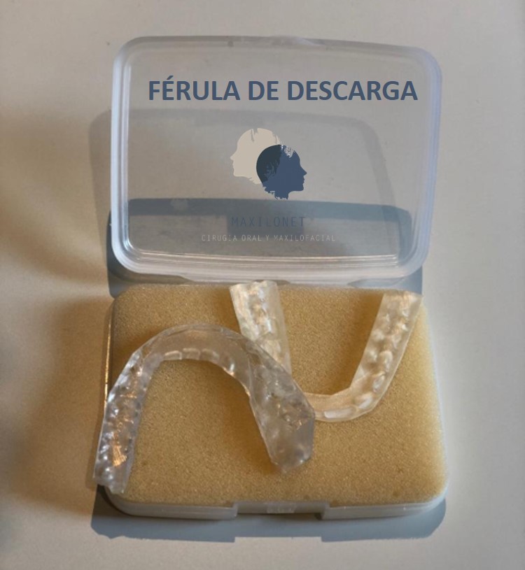Férula de Descarga para el Bruxismo  Clínica Dental MiBO Almería 