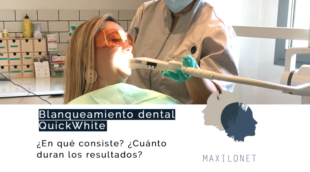 Blanqueamiento dental