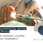 Blanqueamiento dental