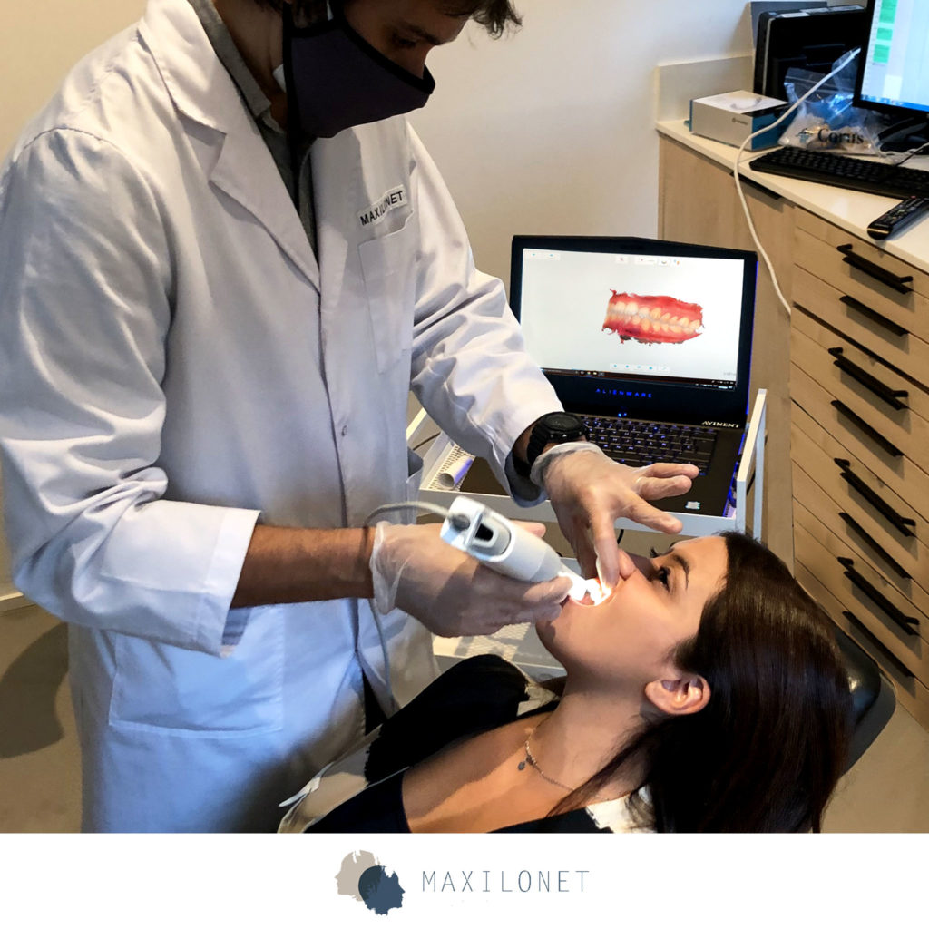 escáner 3 shape Maxilonet