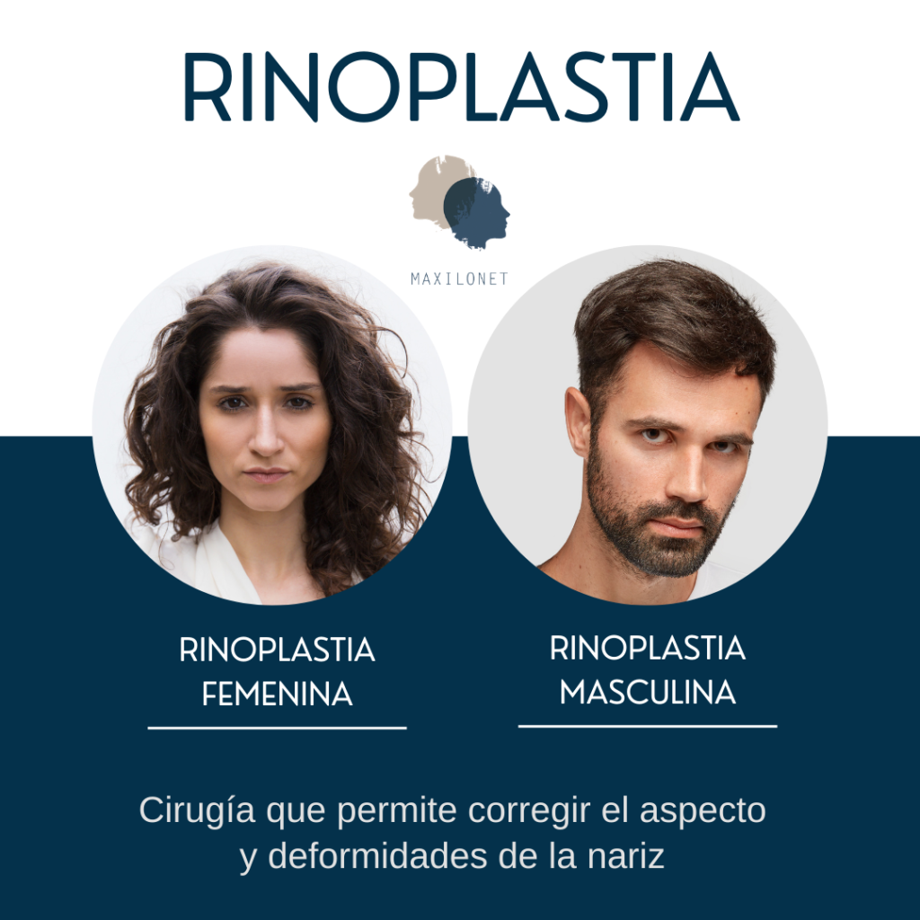 Maxilonet cirujano expertos en rinoplastia en Barcelona Dr. Javier Mareque Bueno